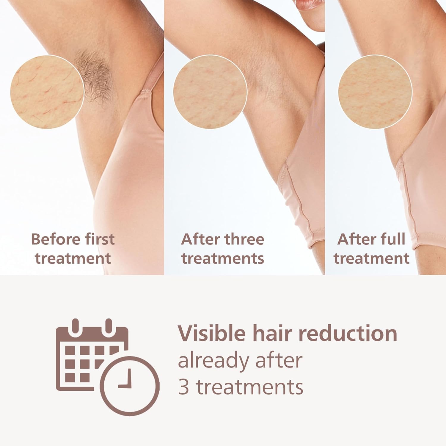 سلسلة فيليبس لوميا 8000، جهاز إزالة الشعر IPL، مستشعر SmartSkin، أداء مثبت سريريًا، 3 ملحقات، موديل BRI938/02 - الصورة 3