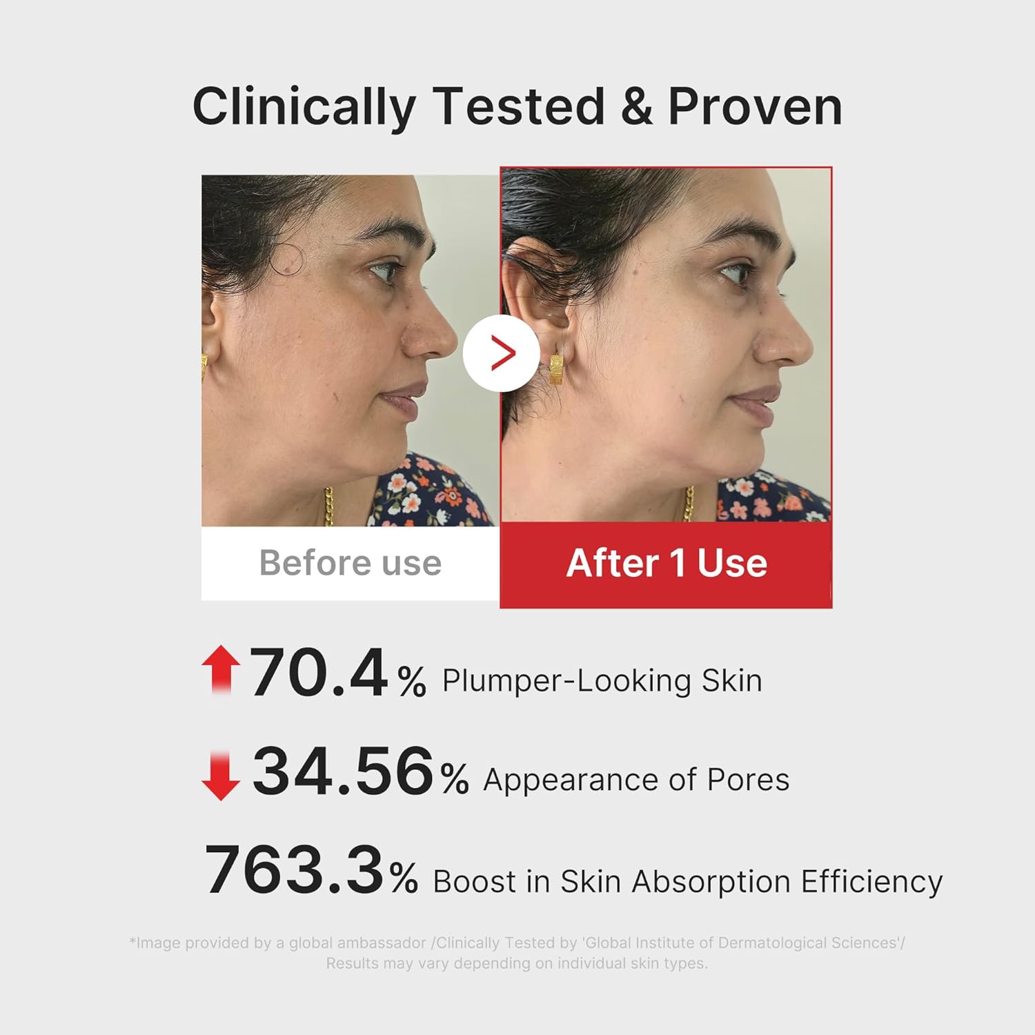 Medicube Age-R Booster Pro وردي | جهاز تليين الزجاج الحقيقي 6 في 1 | بشرة زجاجية ذات امتصاص محسّن، ولمعان، ومرونة، والعناية بالمسام | جهاز العناية بالبشرة LED | كوري - الصورة 5